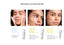 BEST-SELLER KIT - HYAL CEUTIC